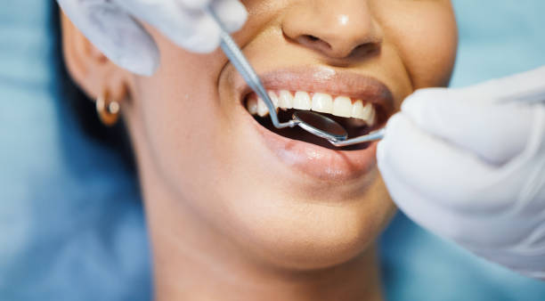 Best Emergency Tooth Extraction in Buckhorn, CA